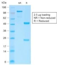 Data from SDS-PAGE analysis of Anti-Beta Catenin antibody (Clone CTNNB1/2030R). Reducing lane (R) shows heavy and light chain fragments. NR lane shows intact antibody with expected MW of approximately 150 kDa. The data are consistent with a high purity, intact mAb.